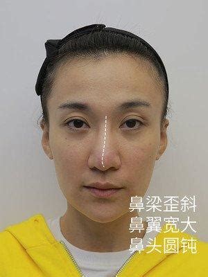 鼻樑起節女面相|鼻樑起節的女人面相性格解析